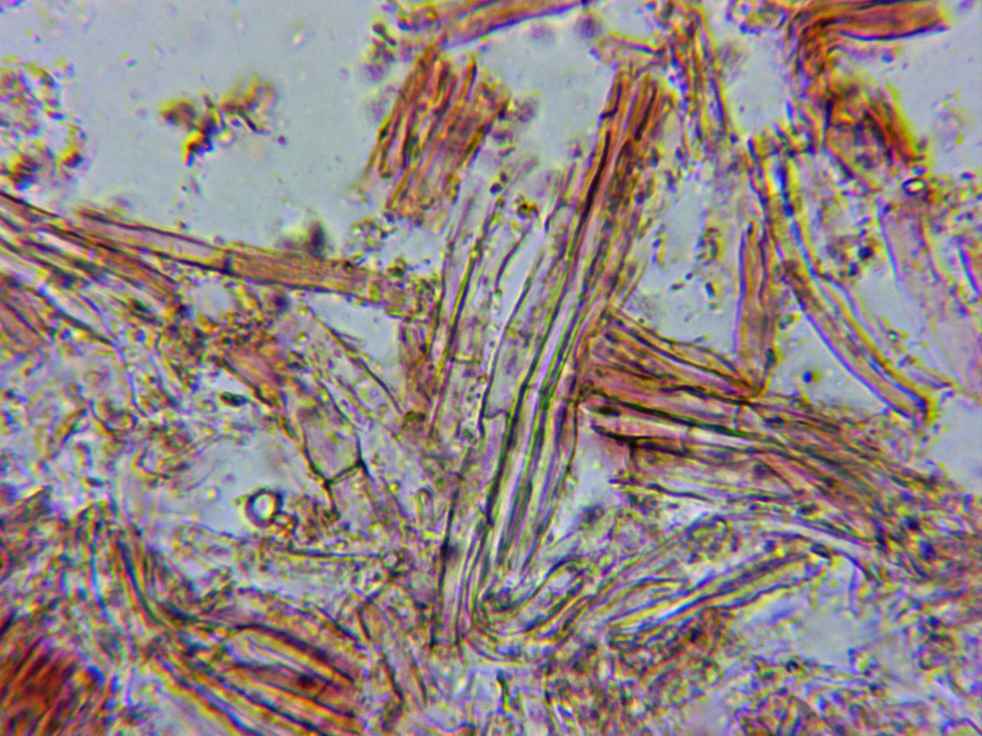 Microscopía de Microglossum nudipes - 10 - Hifas pié 2